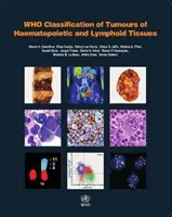 Clasificarea OMS a tumorilor țesuturilor hematopoietice și limfoide - WHO Classification of Tumours of Haematopoietic and Lymphoid Tissues