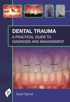 Dental Trauma: Un ghid practic pentru diagnostic și management - Dental Trauma: A Practical Guide to Diagnosis and Management