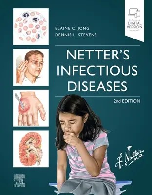 Bolile infecțioase ale lui Netter - Netter's Infectious Diseases