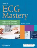 ECG Mastery: Îmbunătățirea abilităților dvs. de interpretare a ECG - ECG Mastery: Improving Your ECG Interpretation Skills