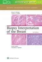 Interpretarea biopsiei sânului (Biopsy Interpretation of the Breast) - Biopsy Interpretation of the Breast