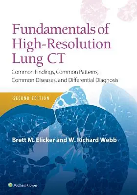 Fundamente ale tomografiei pulmonare de înaltă rezoluție: Constatări comune, modele comune, boli comune și diagnostic diferențial - Fundamentals of High-Resolution Lung CT: Common Findings, Common Patterns, Common Diseases and Differential Diagnosis