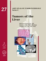 Tumori ale ficatului - Tumors of the Liver