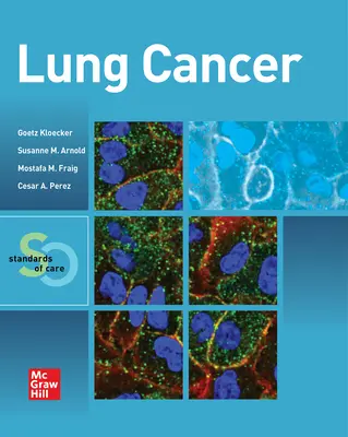 Cancerul pulmonar: Standarde de îngrijire - Lung Cancer: Standards of Care
