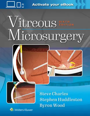 Microchirurgia vitreană - Vitreous Microsurgery