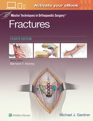 Tehnici de vârf în chirurgia ortopedică: Fracturi - Master Techniques in Orthopaedic Surgery: Fractures
