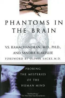 Fantome în creier - Phantoms in the Brain