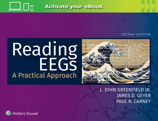Citirea Eegs: O abordare practică - Reading Eegs: A Practical Approach