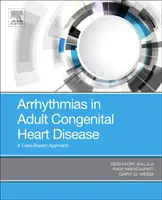 Aritmii în bolile cardiace congenitale la adulți: O abordare bazată pe cazuri - Arrhythmias in Adult Congenital Heart Disease: A Case-Based Approach