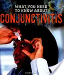Ce trebuie să știți despre conjunctivită - What You Need to Know about Conjunctivitis