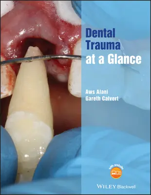Trauma dentară la o privire de ansamblu - Dental Trauma at a Glance