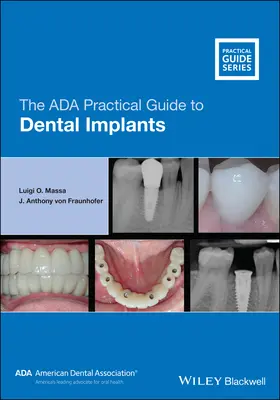 The ADA Practical Guide to Dental Implants (Ghidul practic ADA pentru implanturi dentare) - The ADA Practical Guide to Dental Implants