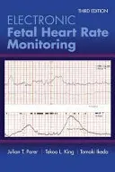Monitorizarea electronică a ritmului cardiac fetal: Sistemul cu 5 niveluri: Sistemul cu 5 niveluri - Electronic Fetal Heart Rate Monitoring: The 5-Tier System: The 5-Tier System