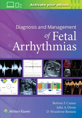 Diagnosticul și managementul aritmiilor fetale - Diagnosis and Management of Fetal Arrhythmias