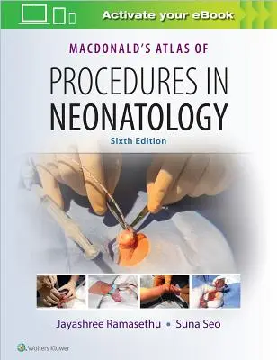 Atlasul procedurilor în neonatologie al lui Macdonald - Macdonald's Atlas of Procedures in Neonatology