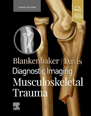 Diagnostic imagistic: Traumatismele musculo-scheletice - Diagnostic Imaging: Musculoskeletal Trauma