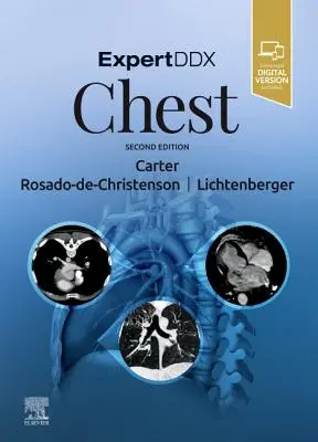 ExpertDDx: Piept - ExpertDDx: Chest