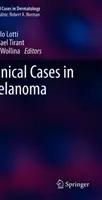 Cazuri clinice în melanom - Clinical Cases in Melanoma
