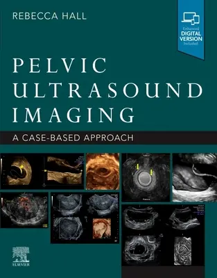 Imagistica pelviană cu ultrasunete: O abordare bazată pe cazuri - Pelvic Ultrasound Imaging: A Cased-Based Approach