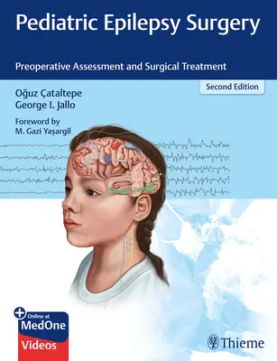 Chirurgia epilepsiei pediatrice: Evaluarea preoperatorie și tratamentul chirurgical - Pediatric Epilepsy Surgery: Preoperative Assessment and Surgical Treatment