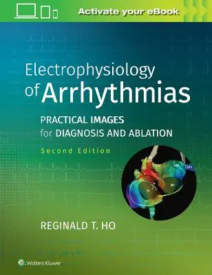 Electrofiziologia aritmiilor: Imagini practice pentru diagnostic și ablație - Electrophysiology of Arrhythmias: Practical Images for Diagnosis and Ablation