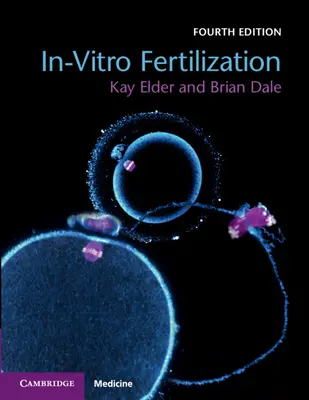 Fertilizarea In-Vitro - In-Vitro Fertilization