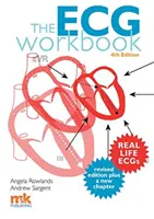 Caiet de lucru ECG - ECG Workbook