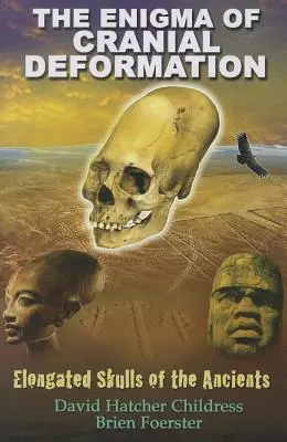 Enigma deformării craniene: Craniile alungite ale anticilor - The Enigma of Cranial Deformation: Elongated Skulls of the Ancients