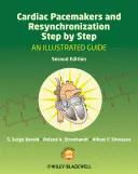 Stimulatoare cardiace și resincronizare pas cu pas: Un ghid ilustrat - Cardiac Pacemakers and Resynchronization Step by Step: An Illustrated Guide