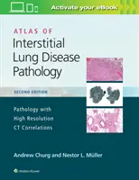 Atlas de patologie a bolilor pulmonare interstițiale - Atlas of Interstitial Lung Disease Pathology