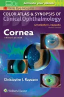 Corneea - Cornea