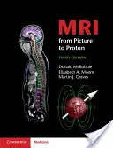 RMN de la imagine la protoni - MRI from Picture to Proton
