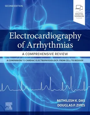 Electrocardiografia aritmiilor: O revizuire cuprinzătoare - Electrocardiography of Arrhythmias: A Comprehensive Review