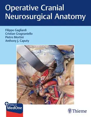 Anatomie neurochirurgicală craniană operativă - Operative Cranial Neurosurgical Anatomy
