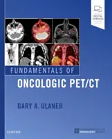 Fundamente ale oncologiei pet/CT - Fundamentals of Oncologic Pet/CT