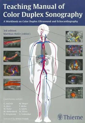 Manual de predare a ecografiei duplex color - Teaching Manual of Color Duplex Sonography
