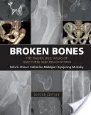 Oase rupte: Atlasul radiologic al fracturilor și dislocărilor - Broken Bones: The Radiologic Atlas of Fractures and Dislocations