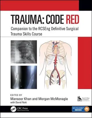 Traumă: Cod roșu: Companion to the Rcseng Definitive Surgical Trauma Skills Course - Trauma: Code Red: Companion to the Rcseng Definitive Surgical Trauma Skills Course