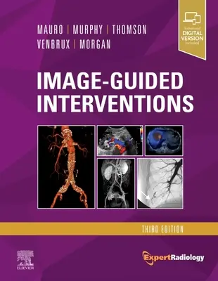 Intervenții ghidate de imagini: Expert Radiology Series - Image-Guided Interventions: Expert Radiology Series