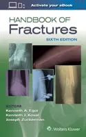 Manual de fracturi - Handbook of Fractures