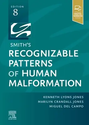 Modele recognoscibile de malformații umane ale lui Smith - Smith'S Recognizable Patterns of Human Malformation