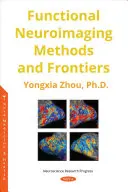 Metode și frontiere ale neuroimagisticii funcționale - Functional Neuroimaging Methods and Frontiers