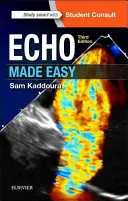 Ecoul făcut ușor - Echo Made Easy