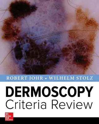 Revizuirea criteriilor de dermoscopie - Dermoscopy Criteria Review