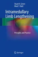 Alungirea intramedulară a membrelor: Principii și practică - Intramedullary Limb Lengthening: Principles and Practice