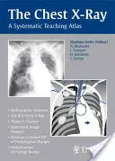 Radiografia toracică: Un atlas de predare sistematică - The Chest X-Ray: A Systematic Teaching Atlas