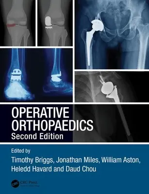 Ortopedie operatorie - Operative Orthopaedics