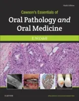 Cawson's Essentials of Oral Pathology and Oral Medicine (Esențialul patologiei și medicinei orale) - Cawson's Essentials of Oral Pathology and Oral Medicine