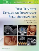 Diagnosticul ecografic al anomaliilor fetale în primul trimestru - First Trimester Ultrasound Diagnosis of Fetal Abnormalities