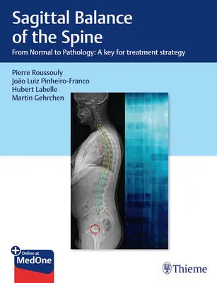 Echilibrul sagital al coloanei vertebrale: De la normal la patologie: O cheie pentru strategia de tratament - Sagittal Balance of the Spine: From Normal to Pathology: A Key for Treatment Strategy